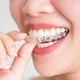 thumbnail image 2 of Juego de tirantes protectores de dientes de silicona, protector bucal, bandeja para blanquear los dientes, 2 uds., 2 of 7