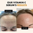 thumbnail image 4 of Sérum Eclat Skincare Vitamina C 30 ml con ácido hialurónico y vitamina E, 4 of 9