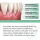thumbnail image 5 of 1-3Pcs Gum Regrowth Drops, Natural Gum Restore Liquid Mouthwash, Gum Therapy Drops Receding Gum Repair Treatment, 5 of 5