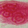 thumbnail image 2 of Trichinella Spiralis Encysted Larvae Slide, W.M., 2 of 2