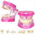 thumbnail image 1 of Modelo de Dientes con Enfermedades Tipodontos Dentales Modelo de Dientes de Implante con Dientes Removibles Demostración Patológica (Rosa, 2 Piezas), 1 of 5