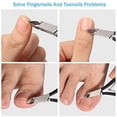 thumbnail image 4 of 8 Pieces Cuticle Nippers Stainless Steel Cuticle Trimmer Pointed Blade Cuticle Cutter Clipper Dead Skin Remover Scissors Manicure Tools for Fingernails and Toenails (Black), 4 of 15