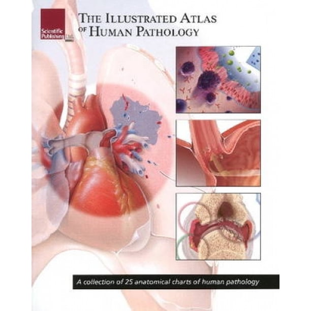 The Illustrated Atlas of Human Pathology: A Collection of 25 Anatomical ...