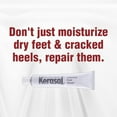 thumbnail image 3 of Kerasal Intensive Foot Repair Skin Healing Ointment, 1 Oz and Moisturizing Gel Socks, One Pair, 3 of 5