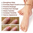 thumbnail image 5 of 1-3pcs Nail Repair Essence Remove Onychomycosis Serum Fungal Treatment Repair Ingrown And Thickened Grey Nails, 5 of 5