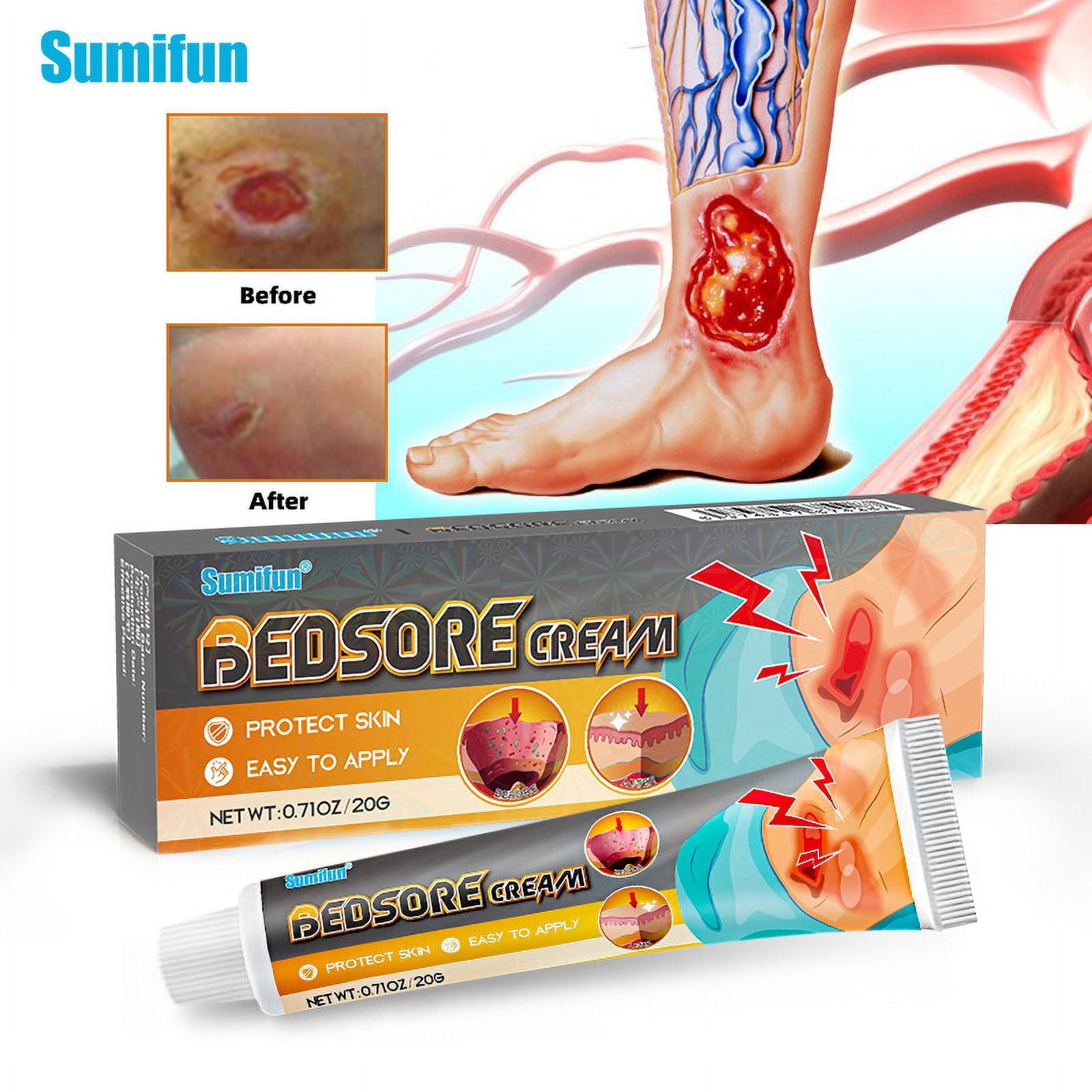 Bedsore Cream Moisturize Decubitus,Ulcer Cream,Rapid absorption,quick-acting,Remove Rots Myogenic Pressure Ulcer Cream Wound Healing Body Care.Wound Healing Cream for Skin Care,3pcs