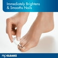 thumbnail image 3 of BriteNow Fungal Nail Treatment for Discolored or Damaged Nails, 0.5 oz, 3 of 8