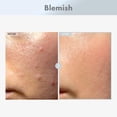 thumbnail image 2 of Sérum facial TOSOWOONG Niacinamida 15% con ácido tranexámico 30 ml, 2 of 6