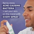 thumbnail image 2 of Aerosol facial Mario Badescu Repair HOCl 60 ml (paquete de 2), 2 of 9