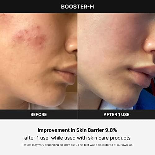 Medicube Age-R Booster H - Korean No.1 Skin Care Device Medicube Age-R Booster H - Korean No.1 Skin Care Device