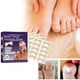 thumbnail image 1 of Parche corrector de uñas de los pies, pegatinas elásticas de corrección de uñas encarnadas, herramientas de pedicura, 1 of 10
