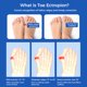 thumbnail image 3 of Juanetes-Protector ortopédico para dedos de los pies, separador de juanetes, Corrector de valgo, Haluksy, 3 of 4