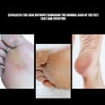 thumbnail image 3 of Broca Para Uñas De Dureza Fuerte Resistente A Altas Temperaturas, Cabezal De Pulido De Uñas, Ligera Para Manicura Y Eliminación De La Piel Muerta De Los Pies, 3 of 7