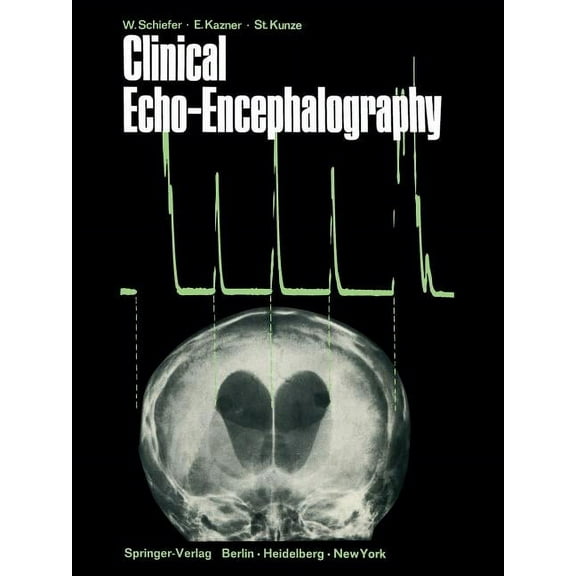 Clinical Echo-Encephalography, (Paperback)