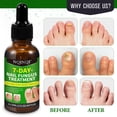 thumbnail image 4 of Ginger Nail Treatment, Ginger Cuticle Care Oil for Nails - 4 x 30ML, 4 of 9