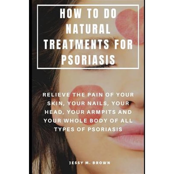 Pre-Owned How to Do Natural Treatments for Psoriasis: Relieve the Pain of Your Skin, Your Nails, Your Head, Your Armpits and Your Whole Body of All Types of Pso