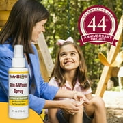 NutriBiotic Skin & Wound Spray with GSE, Plus Tea Tree & Lemon Essential Oils, 4 Fl Oz