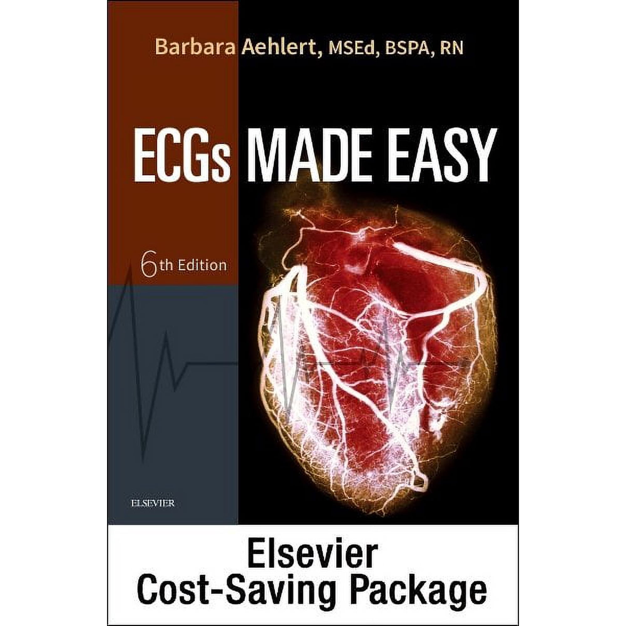 ECGs Made Easy