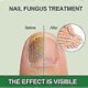 thumbnail image 2 of Nail Care Treatment, Fingernails and Toenails for Nail Care, Brittle Nails Protection & Strengthening, Fast Acting Nail Treatment, 2 of 5