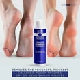 thumbnail image 5 of Blue Cross Professional Nail Care, Extra Strength Callus Remover Gel for Heel or Feet, File, Shaver, Scrubber & Pumice Stone Alternative for at Home Manicure/Pedicure Results, 16 Ounce, 5 of 7