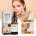 neurontin serum