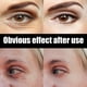 thumbnail image 3 of Eelhoe Eye Cream Moisturizing Hydrating Firming Improving Dark Circles, 3 of 3