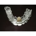 thumbnail image 6 of Clear Essix Pontic Retainer, 6 of 8