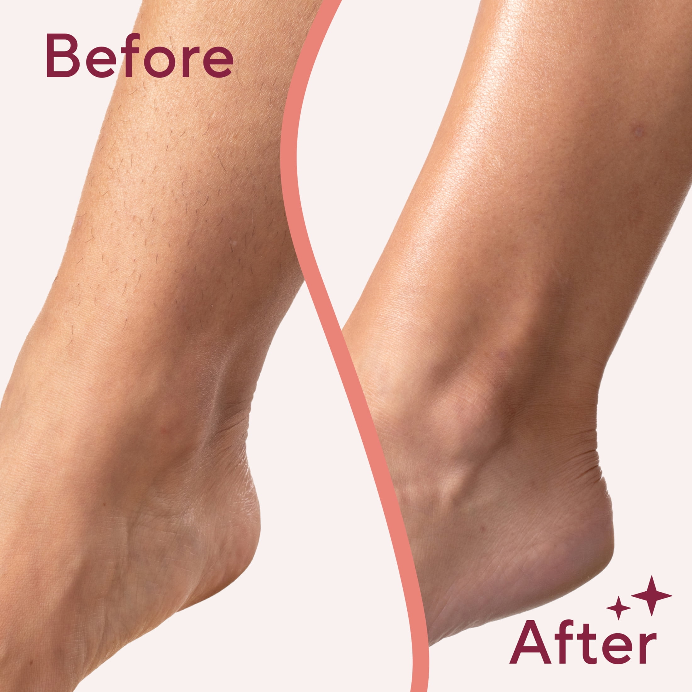Finishing Touch Flawless Legs, Electric Razor for Women, Pivoting Head Leg Hair Remover with LED Light for Instant and Painless Leg Hair Removal