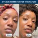 thumbnail image 3 of Parches para espinillas CLEAN SKIN CLUB Derma Dot Hydrocoloid Vegan, 3 of 7
