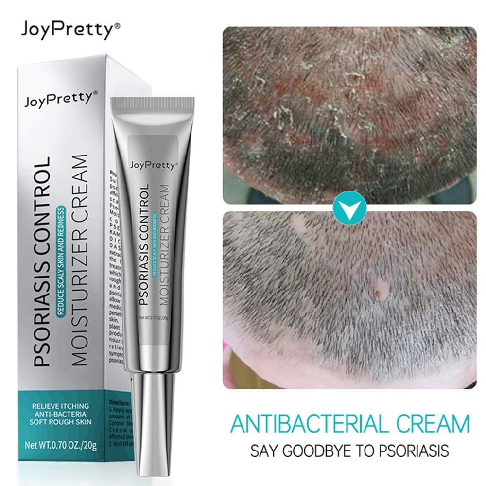 Joypretty Itchy Skin Ointment Psoriasis Ointment Herbal AntiItch Skin