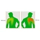 thumbnail image 3 of Shoulder Brace Support for Injury and Tear Relief, 3 of 5