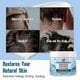 thumbnail image 2 of 2025 Seborrheic Dermatitis Cream, Anti Fungal Shampoo, Scalp Treatment for Psoriasis, Folliculitis, Dry Scalp, Anti-Itch, Sooth, 2 of 5