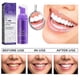 thumbnail image 4 of Tooth Whitening Mousse Foam Tooth Whitening Cottector Professional Teeth Stains Removal Toothpaste, 4 of 5