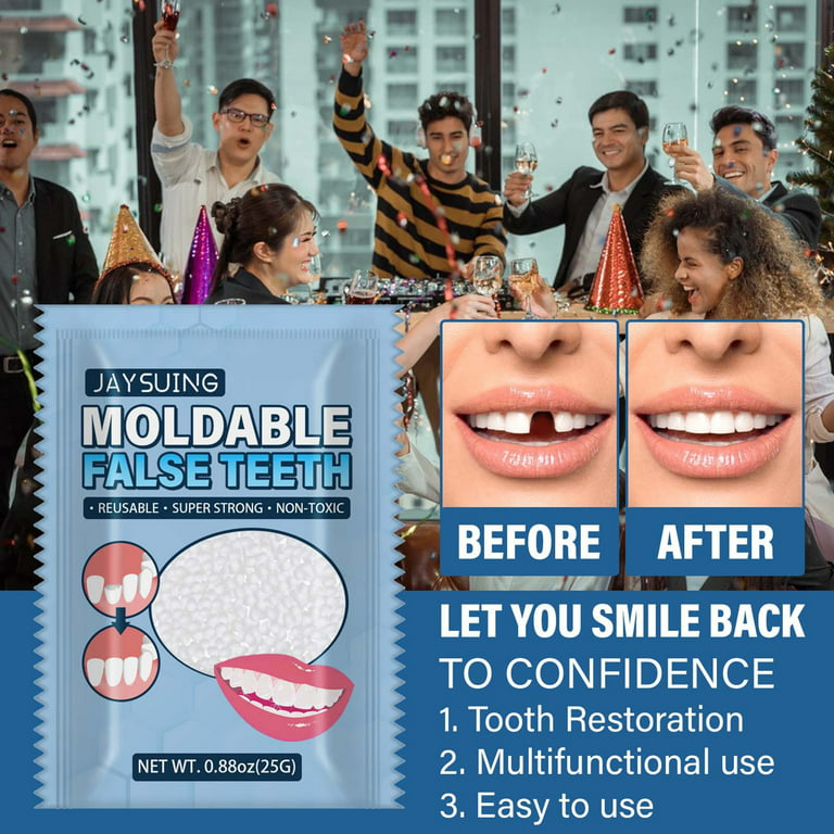 Travelwant 25g/Bag Teeth Repair, Temporary Teeth replacement kit, Moldable  False Teeth, Thermal Fitting Beads for Snap On Instant and Confident Smile