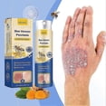 thumbnail image 3 of Fast-acting psoriasises spray with anti-itch formula, 3 of 5