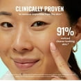 thumbnail image 4 of Good Molecules Pimple Patches - 60ct, 4 of 6