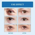thumbnail image 5 of Crema reparadora de péptido de veneno de serpiente original para ojos, reafirmante, elimina el Edema, antiarrugas, aclara las líneas finas y ilumina, 5 of 5