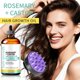 thumbnail image 2 of Rosemary Castor Hair Oil Set - Organic Growth Treatment, 2 of 5