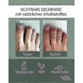 thumbnail image 4 of Aloe Vera & Tea Tree Oil Nail Care Treatment Pen for Fungal Concerns, Quick Intensive Formula, 5-Pack Cosmetic Tool for Healthy Nails, 4 of 5
