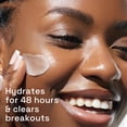 thumbnail image 4 of Crema hidratante Cetaphil Gentle Clear Matificante Acné 90 ml, 4 of 9