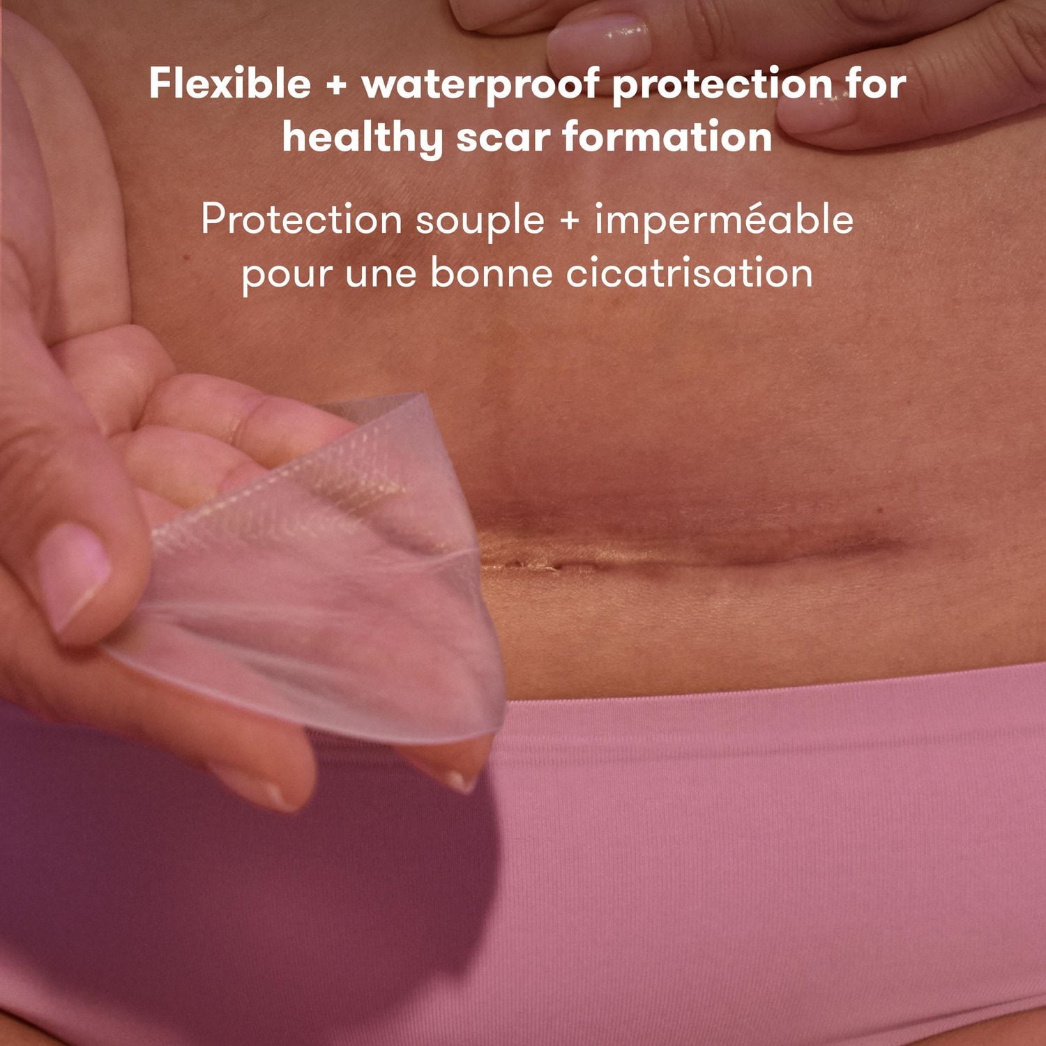 Frida Mom - C-Section Silicone Scar Patches Silicone Strips, C-Section Recovery Must Have Scar Patches, Reusable Medical Grade Treatment for Keloid Scars, Includes Case & Pouch, 6 Pack