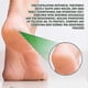 thumbnail image 5 of Foot Peeling Spray Oil, Foot Peeling Spray for Remove Dead Skin, Pedicure Dead Skin Exfoliator for Cracked Rough Heels, Dry Toe Skin & Calluses, Quick, 5 of 5