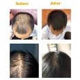 thumbnail image 1 of Aerosol Para El Crecimiento Del Cabello Suero para el cuidado del cabello de 20 ml, suero para el cabello de crecimiento rápido de jengibre eficaz, productos para el cuidado del cabello Likrtyny Cuidado Belleza, 1 of 9