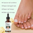 thumbnail image 3 of 7-Day Tea Tree Ginger Nail Fungus Treatment Nail Renewal Liquid Strengthening for Damaged & Toenails, 3 of 5