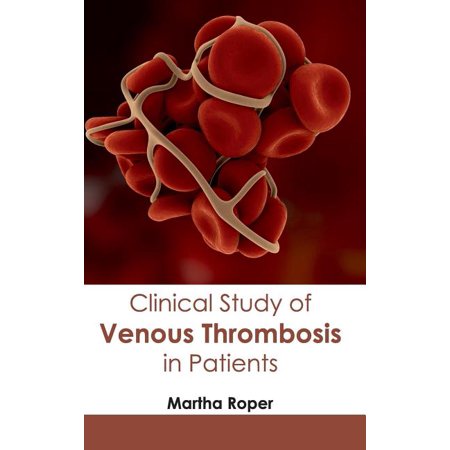 ISBN 9781632410887 product image for Clinical Study of Venous Thrombosis in Patients (Hardcover) | upcitemdb.com