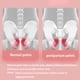 thumbnail image 4 of Likrtyny Thigh Master Pélvico Con Mostrador para Mujer en Casa (gris), 4 of 7