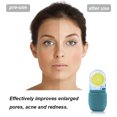 thumbnail image 3 of 1 aplicador de belleza facial, herramientas para el cuidado de la piel, masaje de afeitado con hielo, molde de hielo de silicona para belleza facial., 3 of 5