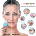 thumbnail image 4 of Limpiadores faciales, espátula facial vibratoria, eliminador de puntos negros, 4 of 5