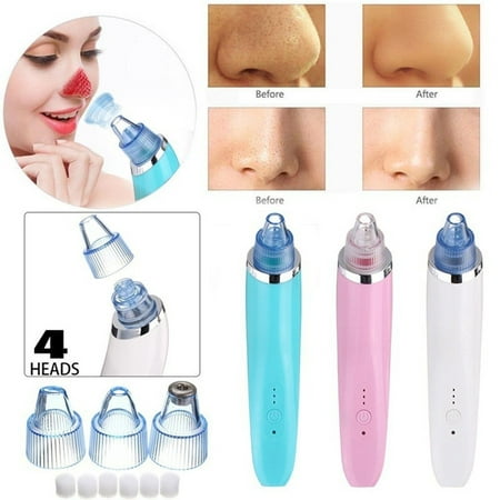 Blackhead Remover Facial Face Pore Cleaner Remover Vacuum Suction Extractor with 4 Microcrystalline Head for Women and