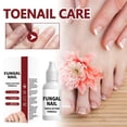 thumbnail image 4 of 15ml Nail Repair Solution For Cuticle Care And Nail Strengthening, 4 of 8